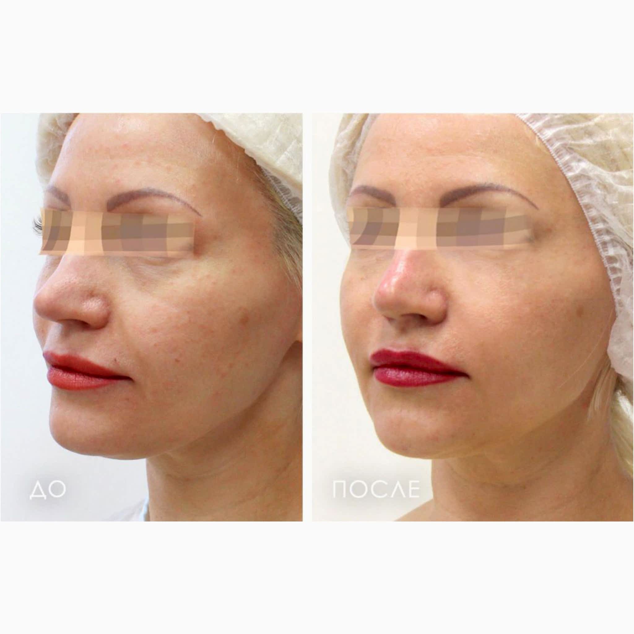 image-20-05-22-02-50-2